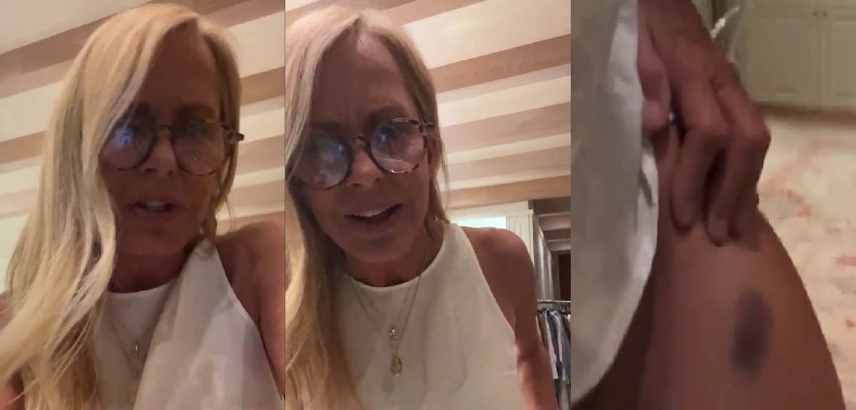 Cecilia Bolocco relató particular accidente doméstico que sufrió en su hogar: 