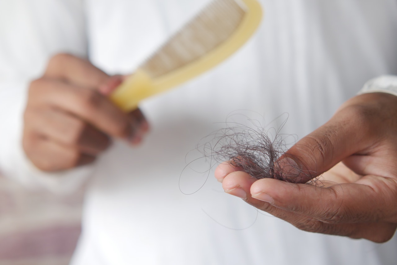 Caída cabello alopecia efecto covid-19