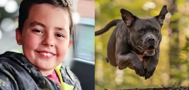 Niño 10 años mutilado perro american bullie