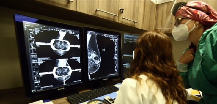 niña chilena 7 años cáncer de mama mastectomía
