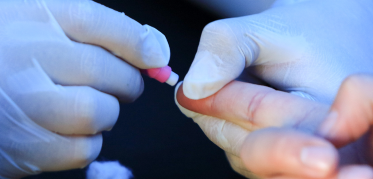 Seremi de Salud rectifica cifras de operativo de test VIH en la RM.