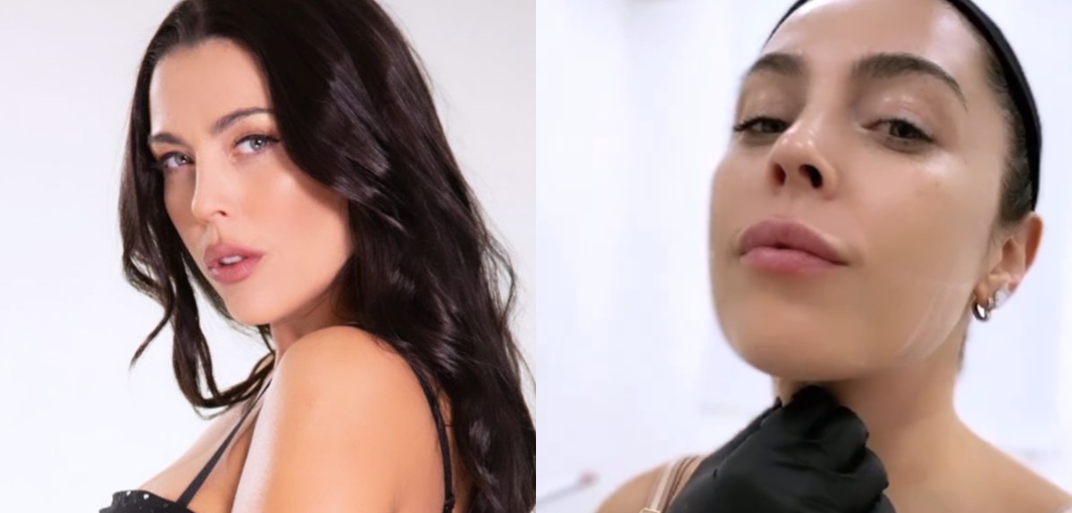 Daniela Aránguiz se sometió a cirugía plástica en su rostro y mostró resultado en videos: "Feliz"