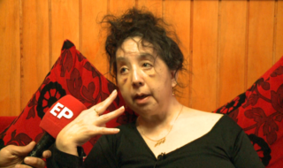 Familia de la región de Magallanes pide ayuda al vivir con rara enfermedad: madre e hijos la tienen