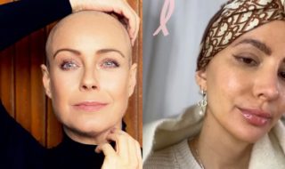 Cáncer de mama triple negativo: los detalles del diagnóstico que afecta a Aylén Milla y Claudia Conserva