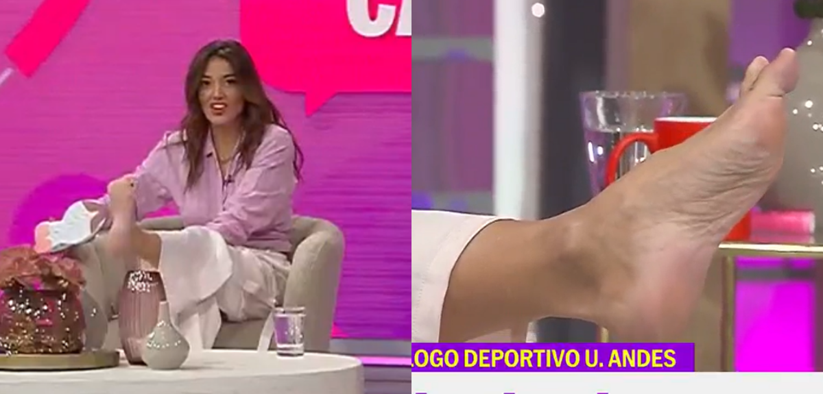 Yamila Reyna sorprendió en 'Hoy se habla' al mostrar su juanete.