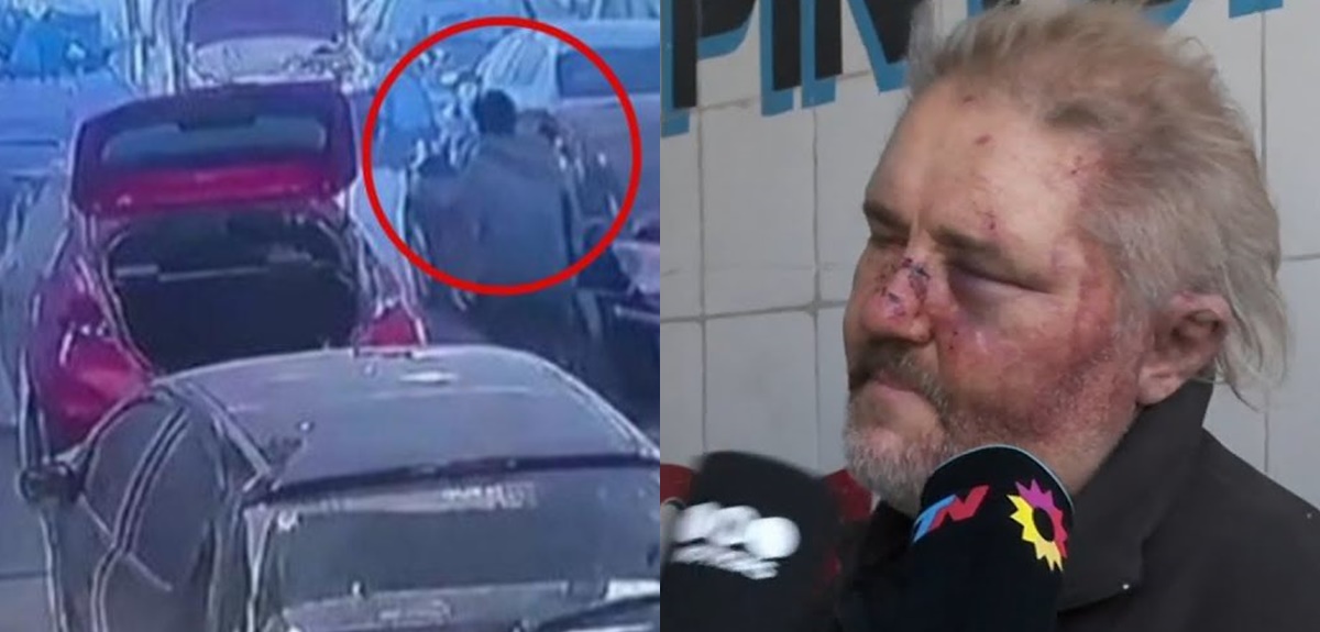 Mecánico sufrió brutal golpiza en Argentina por demorar entrega de auto: le desfiguraron el rostro