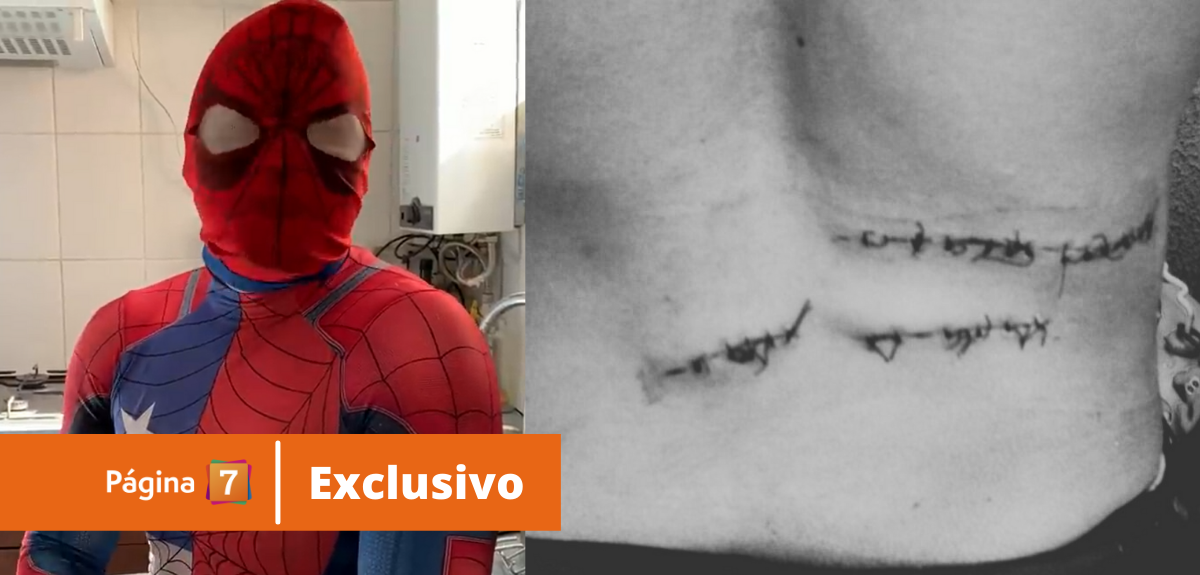 Sensual Spiderman contó detalles de brutal golpiza que sufrió: “Porque soy extranjero me atacaron”