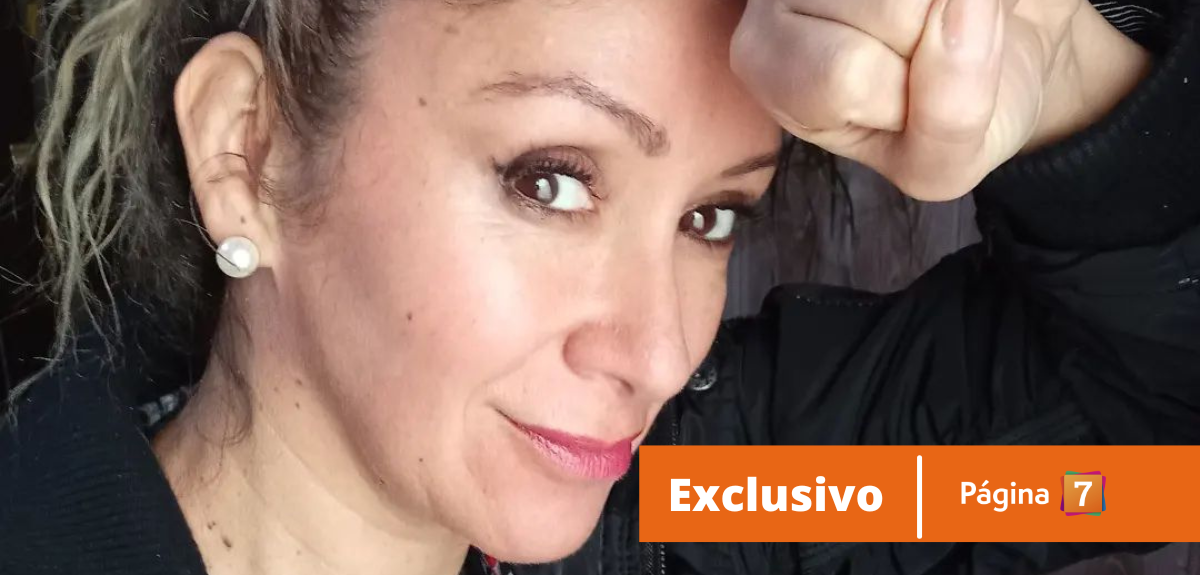 Angélica Sepúlveda sobre cómo enfrenta la alopecia que padece: "Hubo un momento de frustración"