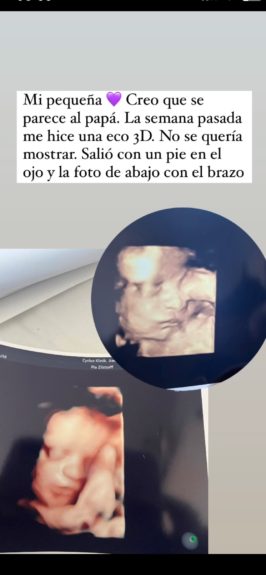 Natalia Arenita Rodríguez compartió eco 3D de su hija en recta final de su embarazo: “Mi pequeña”