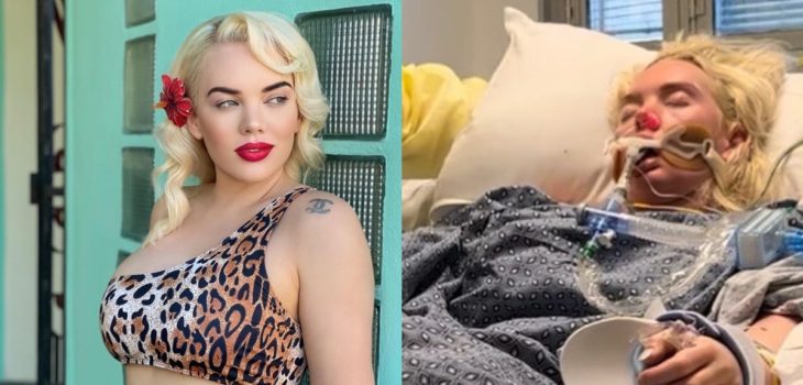 Modelo Jennifer Barlow sufrió amputación de su pierna: se infectó con bacteria carnívora
