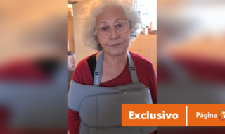 Teresita Reyes relata fuerte caída desde escalera de su casa.