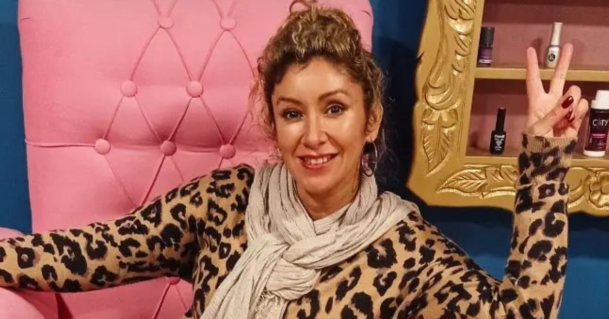 Angélica Sepúlveda contó su experiencia con la alopecia y cómo la ayudó la planta de marihuana