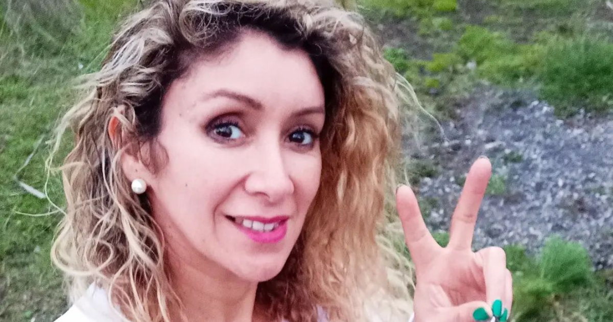 Angélica Sepúlveda contó que se inyecta bótox cada 8 meses: así luce su rostro tras la intervención