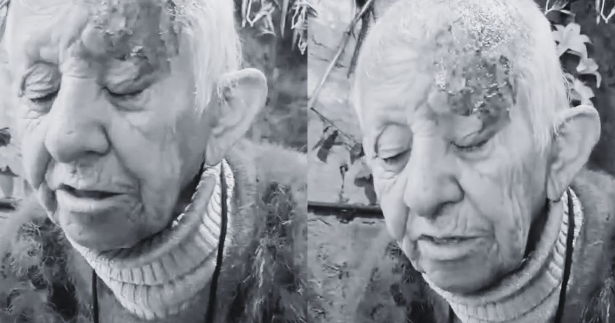 Adulta mayor fue quemada con ácido en La Florida