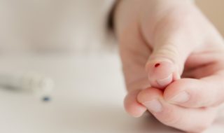 ¿Manchas oscuras en la piel? Conoce los síntomas más comunes de la diabetes