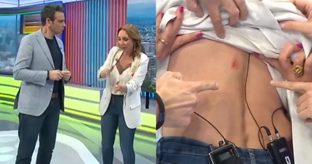 accidente karen Doggenweiler