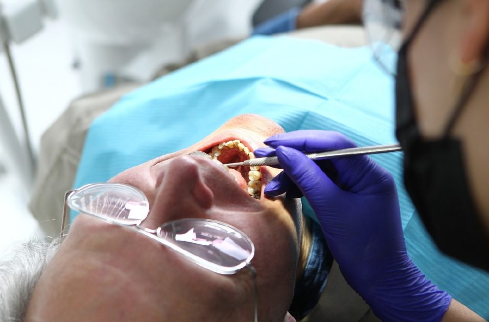 advertencias blanqueamiento dental