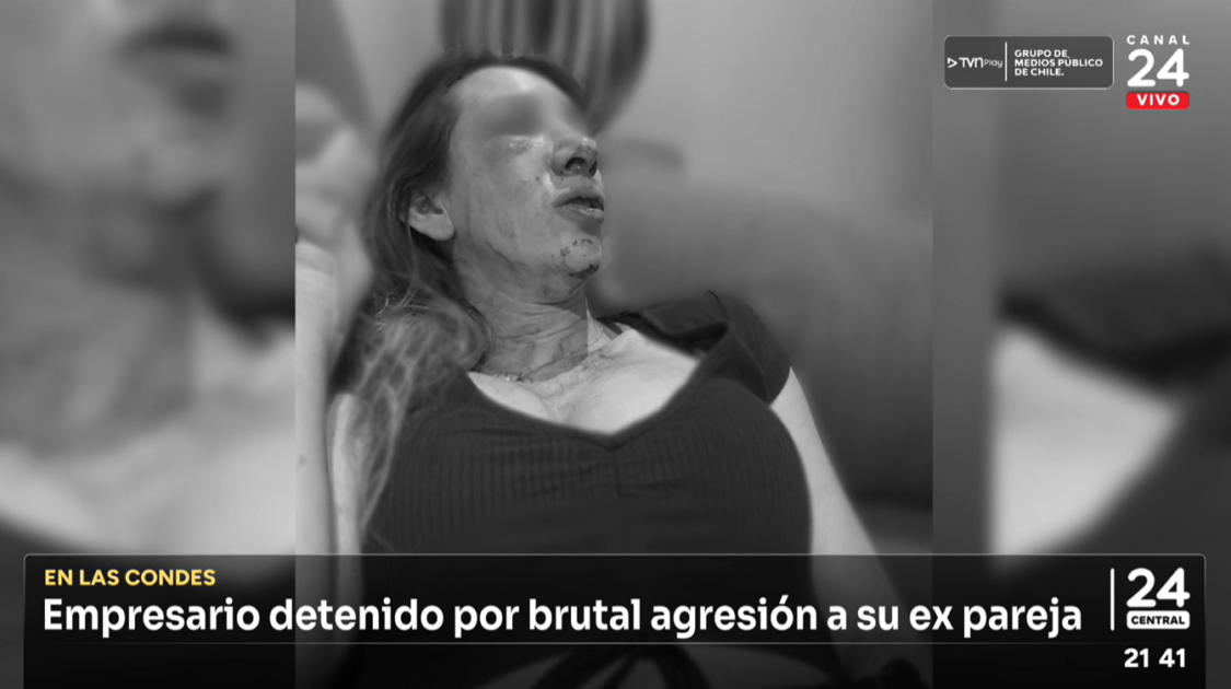 Empresario fue detenido tras brutal agresión a expareja en Las Condes