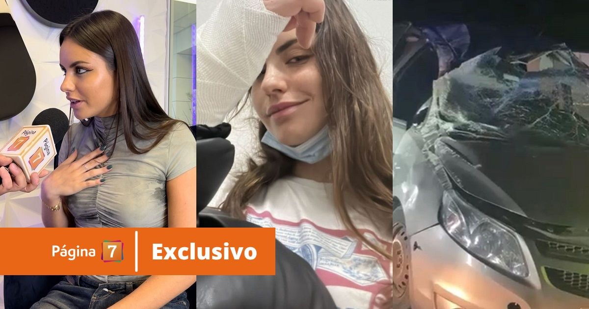 Emilia Dides recordó fuerte accidente automovilístico y mostró la cicatrzi que le dejó