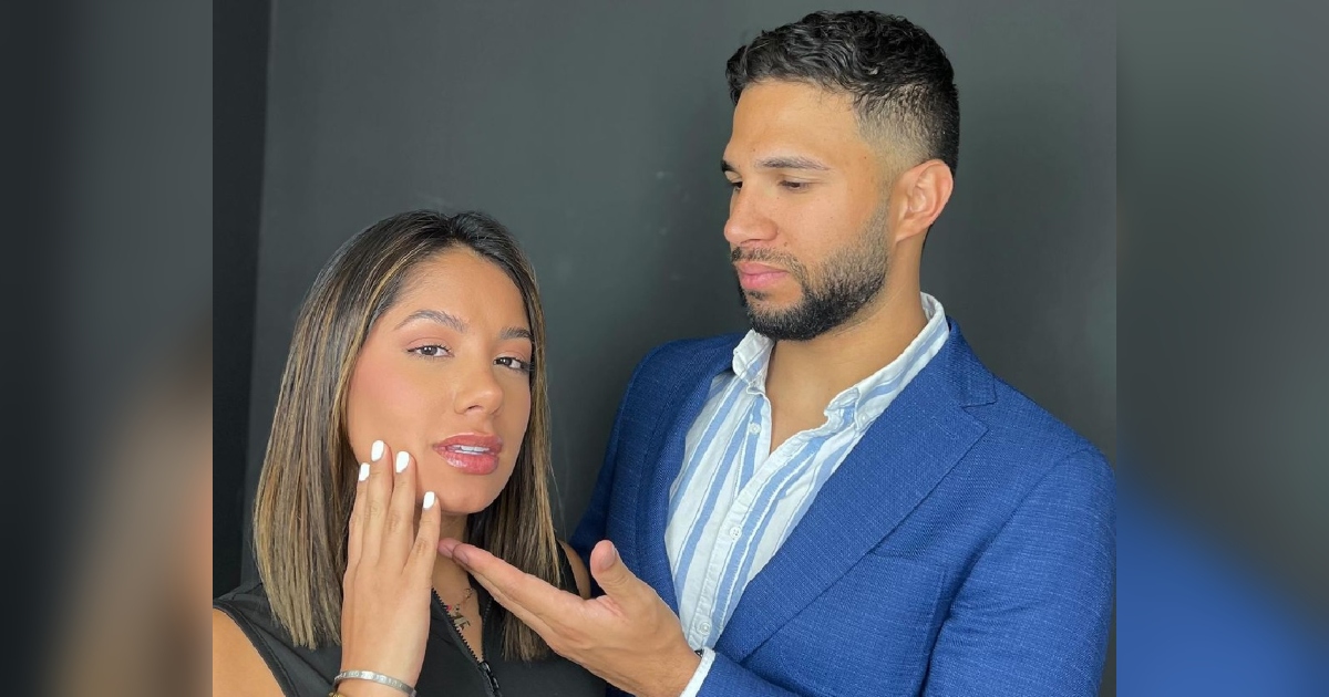 Actriz Nathalie Vera mostró perfilado de labios con ácido hialurónico