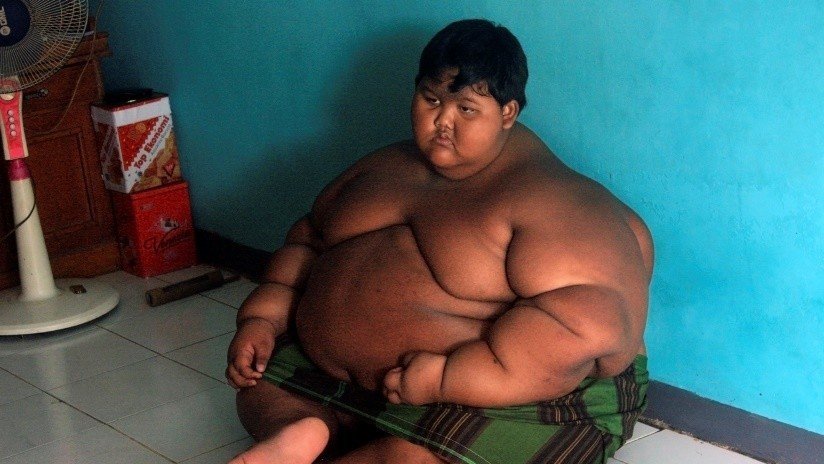 Así luce hoy el niño más gordo del mundo