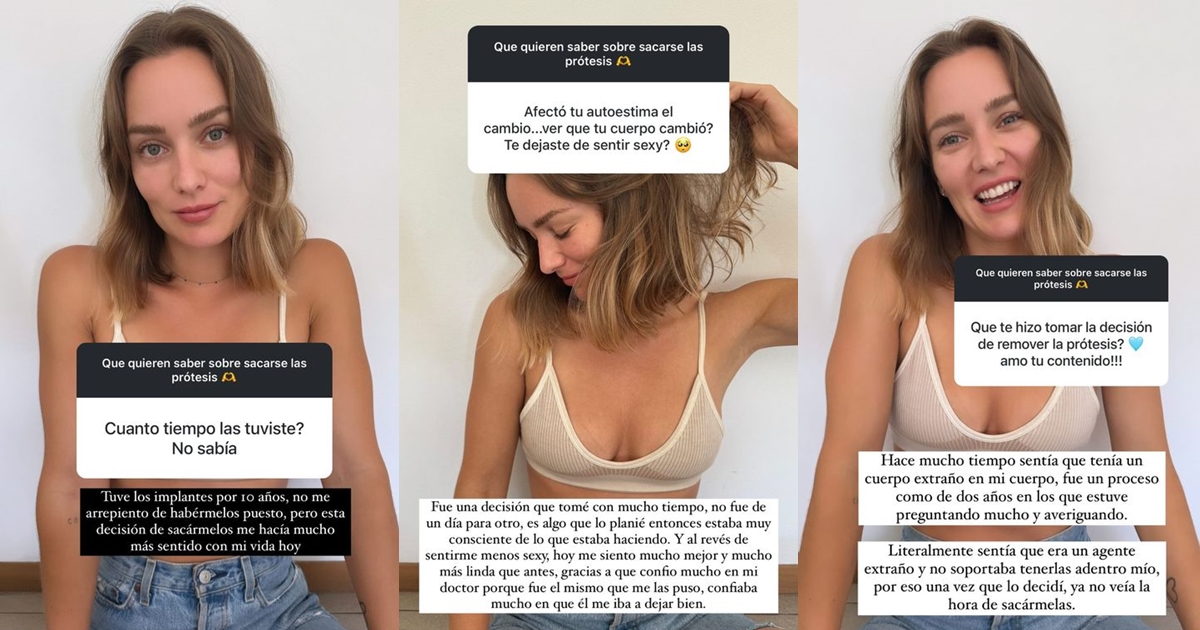 Kika Silva y por qué decidió retirarse sus implantes mamarios: "No soportaba tenerlos dentro mío"