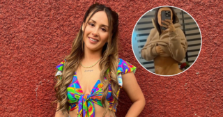 Azzartt Maveth mostró resultado de lipoescultura a 6 días de su cirugía: "El único dolor que acepto"