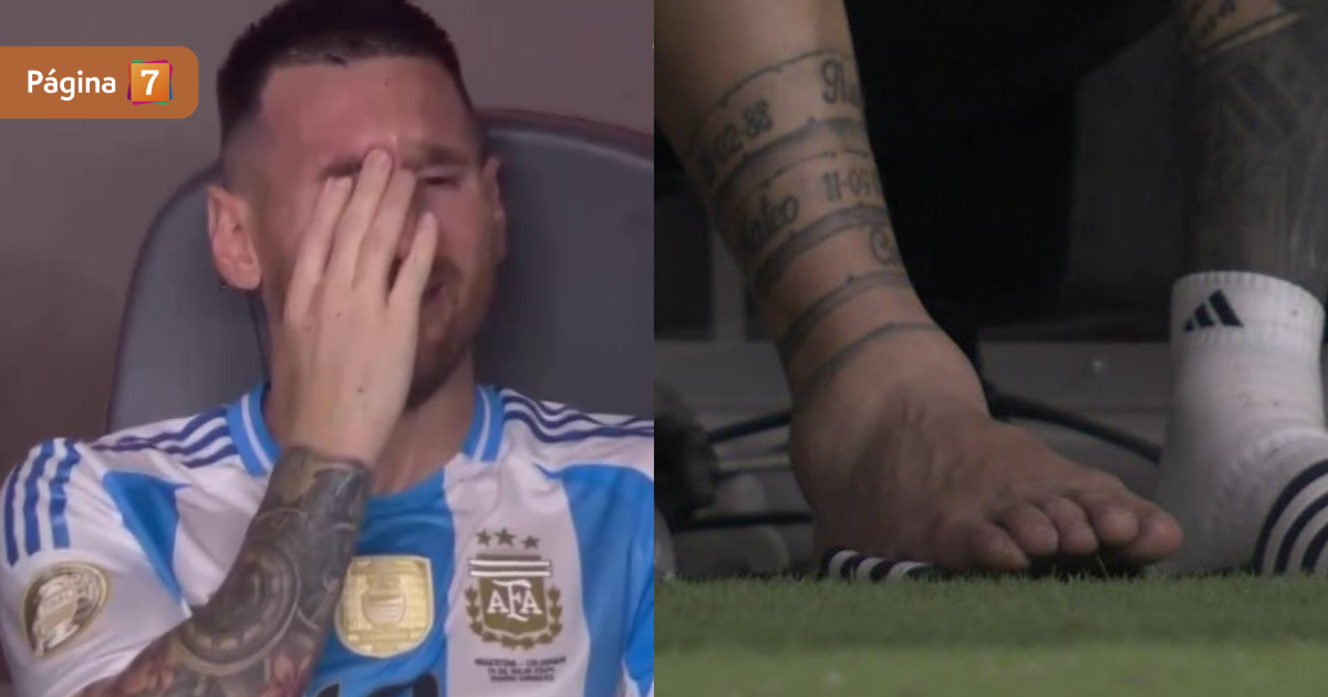 Así quedó el tobillo de Lionel Messi en final de Copa América: revisa el video de la lesión