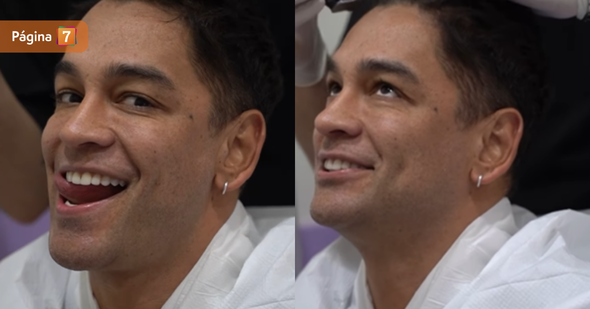 Thiago reveló que se sometió a procedimiento estético Nada me detendrá