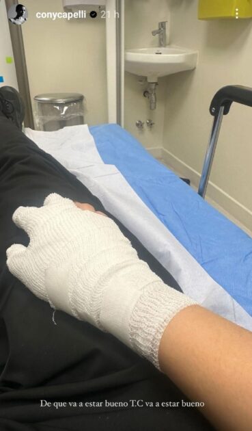Cony Capelli sufrió doloroso accidente durante grabación de Top Chef VIP: compartió foto