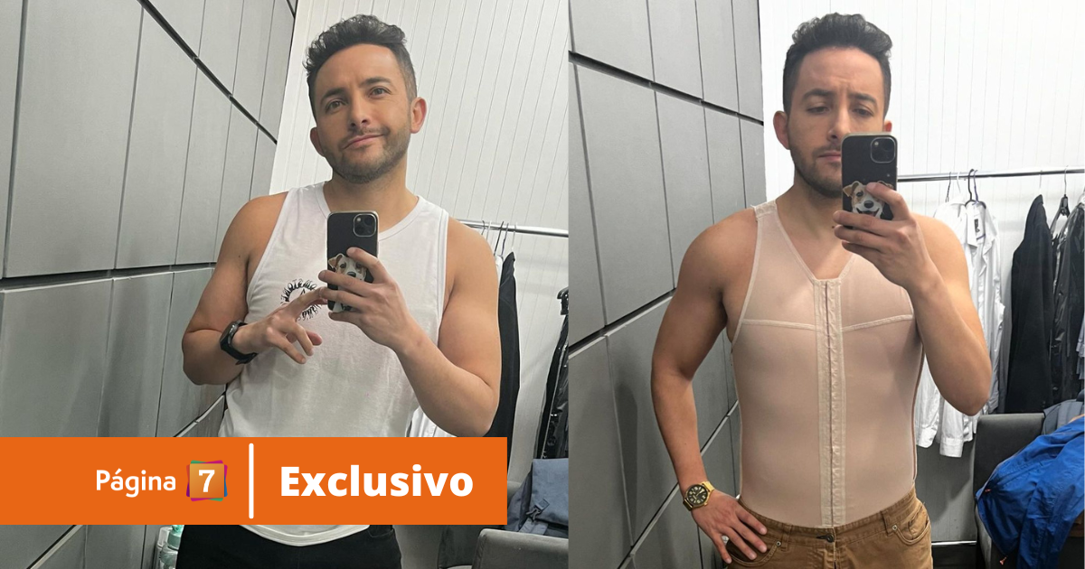 Hugo Valencia dio detalles de la recuperación tras mini lipo