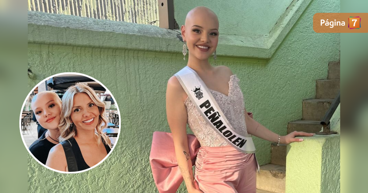 Hija de Nicole Pérez lanzó conmovedora reflexión sobre su alopecia y el Miss Mundo Chile