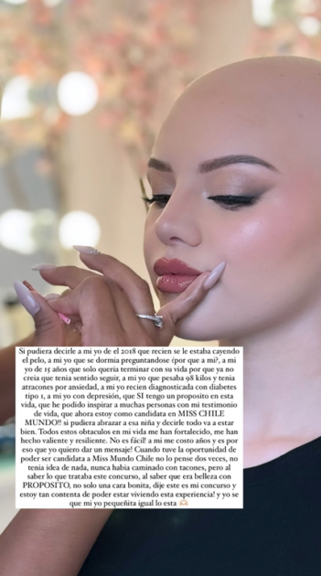 Hija de Nicole Pérez lanzó conmovedora reflexión sobre su alopecia y el Miss Mundo Chile