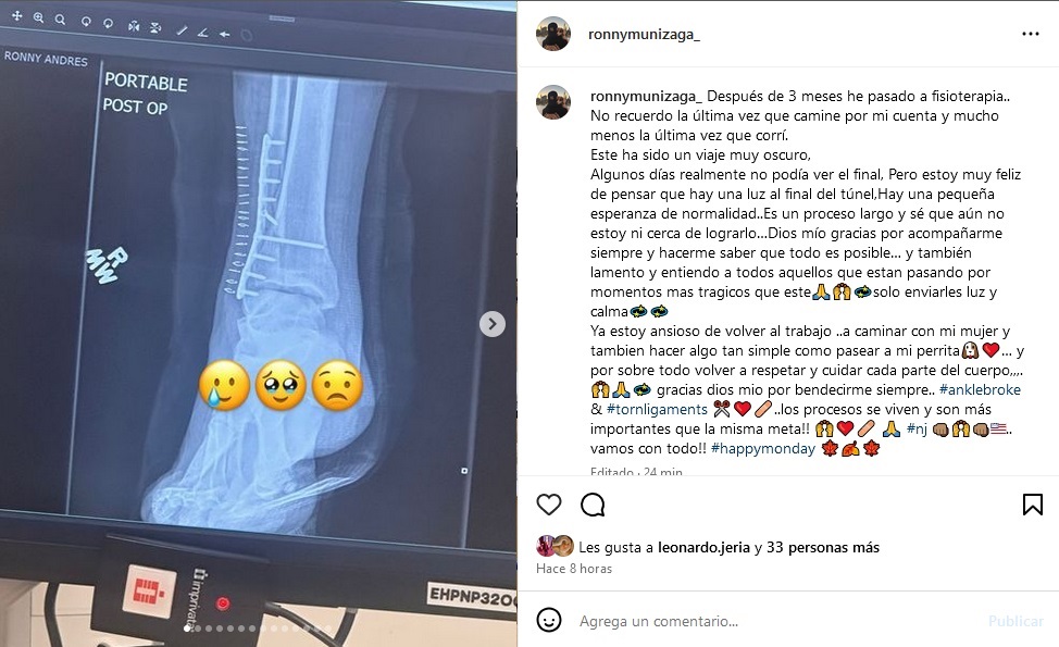 Ronny Dance mostró su lesión