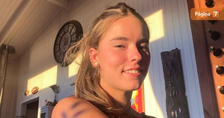 Milagros Zabaleta reveló cómo quedó su cara tras procedimiento estético: 