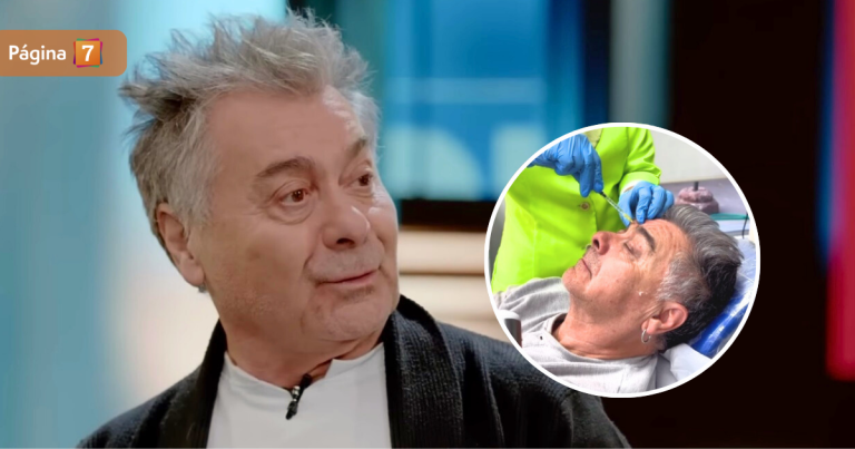 Pato Torres mostró resultados de nuevo tratamiento estético en su rostro: optó por inyectarse bótox