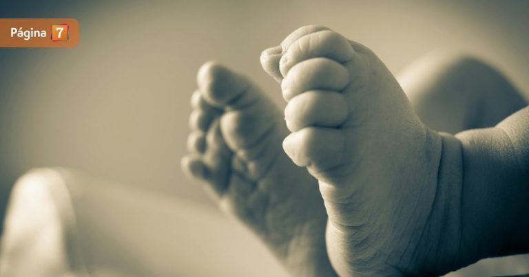 Confirman fallecimiento de siamesas tras problemas de salud: esperaban operación para ser separadas