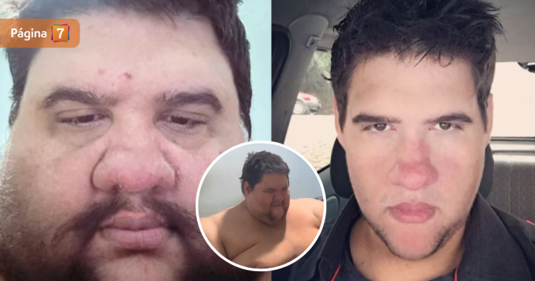 Quién era Gabriel Freitas, el influencer que murió y que logró bajar 200 kilos en un año