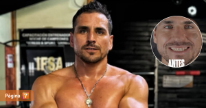 Pangal Andrade mostró antes y después tras someterse a procedimiento dental: Ranty se lo recomendó