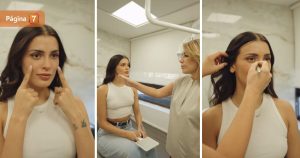 Cony Capelli mostró el antes y después tras procedimiento estético en su rostro