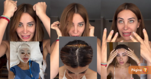 Daniela Requena detalló proceso de feminización facial: "Me despegaron la piel de la cabeza"