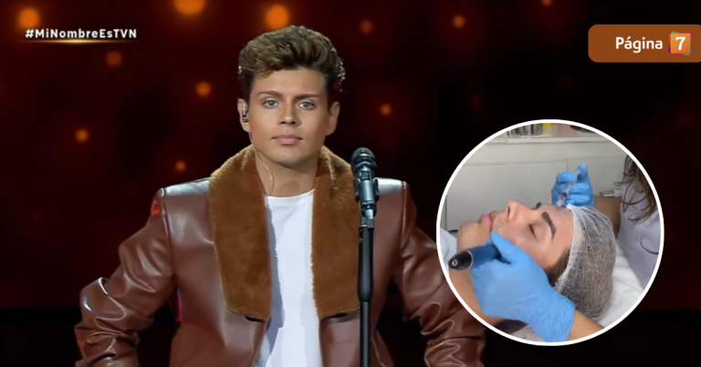 El tratamiento facial que mantiene perfecto al imitador de Luis Miguel en 'Mi Nombre Es'