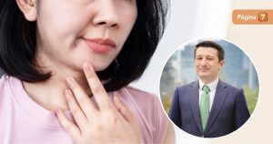 Tras confesión de Alberto Precht, abogado del Buenos días a todos: ¿cómo tratar la parálisis facial?