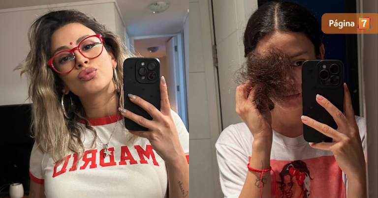 Karla Melo compartió sincera reflexión sobre los efectos de la quimioterapia en su cabello