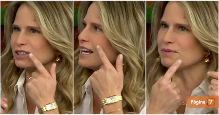 Soledad Onetto explicó en 'Tu Día' qué le pasó en el rostro: tiene relación con su pequeño hijo