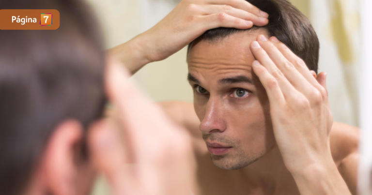 ¿Cuánto cuesta realizarse un implante de cabello en Chile? Esto y todo lo que debes saber