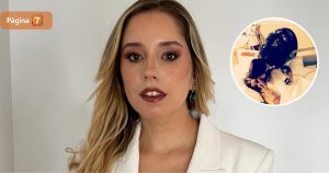 Fernanda Cornejo mostró el antes y después tras operación de escoliosis: “La recuperación es lenta”