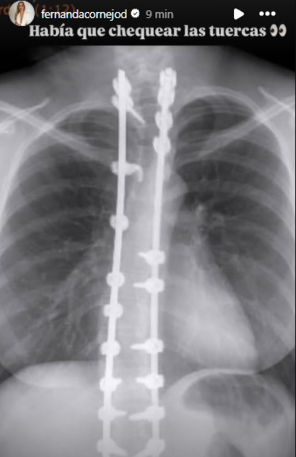 Operación de Fernanda Cornejo