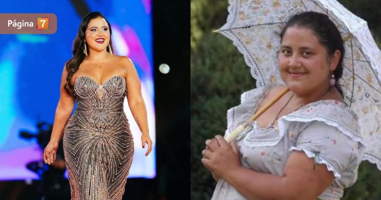 Pamela Leiva reflexionó sobre la cirugía que le cambió la vida: 