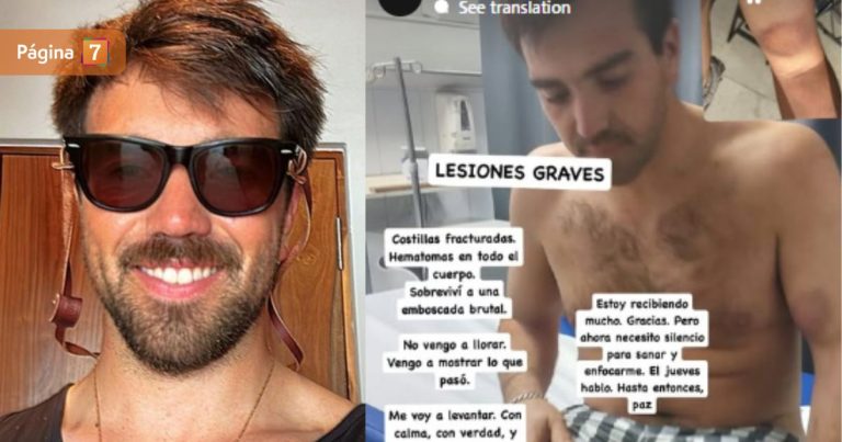 Agresor de conserje en Vitacura asegura que fue víctima de golpiza: 